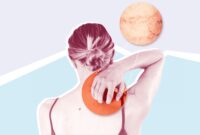 3 Common Allergy Rashes—and What They Look Like